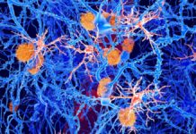 Mladé imunitní buňky odvracejí příznaky Alzheimerovy choroby u myší