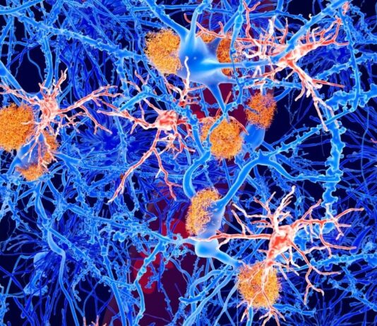 Молоді імунні клітини усувають симптоми хвороби Альцгеймера у мишей