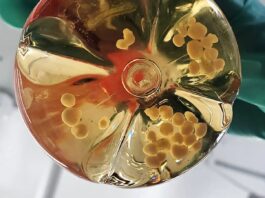 Вирощений у лабораторії мозок отримує життєво важливі покращення: функціональні кровоносні судини