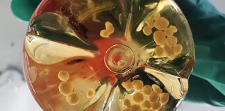 Вирощений у лабораторії мозок отримує життєво важливі покращення: функціональні кровоносні судини