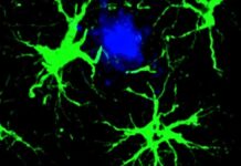 Вчені зменшили амілоїдні бляшки на 50% у мишей за допомогою сконструйованих клітин