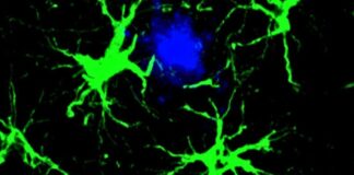 Des cellules modifiées réduisent de 50 % les plaques amyloïdes chez la souris, ce qui est prometteur contre la maladie d’Alzheimer