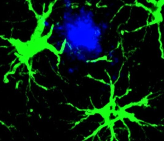 Вчені зменшили амілоїдні бляшки на 50% у мишей за допомогою сконструйованих клітин