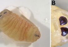 Рідкісна паразитарна інфекція: коли личинки овечої олениці дозрівають усередині людини
