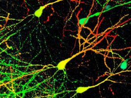 Загадковий препарат «Сполука X» демонструє перспективні результати у боротьбі з білками при хворобі Паркінсона