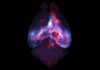 A Hidden “Subway System” in the Brain: New Astrocyte Networks Revealed