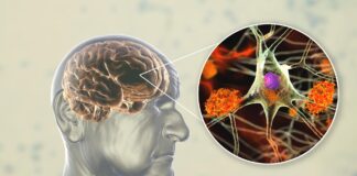 Polyphenol-rich diets and healthy brain aging: What Semmelweis researchers actually found